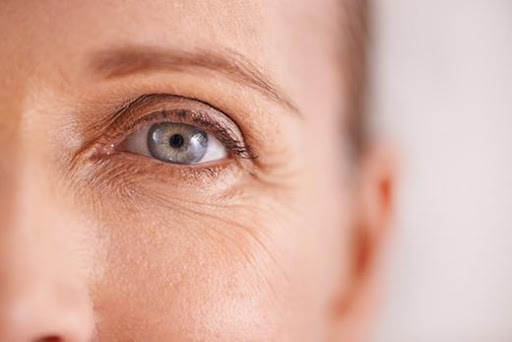 Is it Ever Too Late to Start Botulinum Toxin?