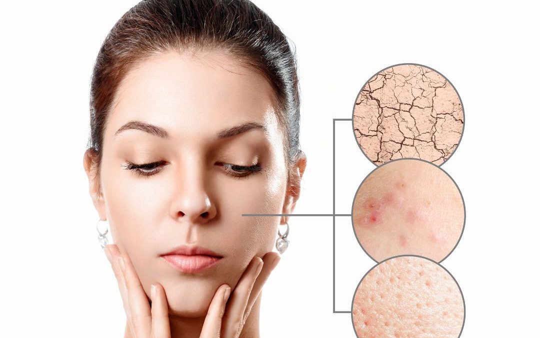 Causes of Dry Skin