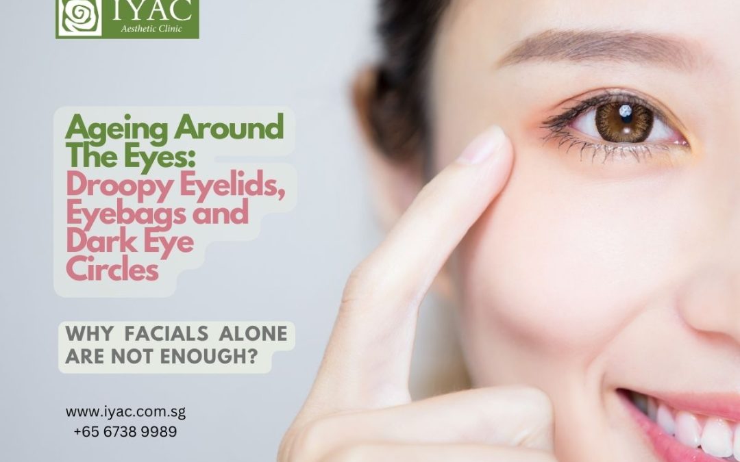 Ageing Around The Eyes: Droopy Eyelids, Eyebags and Dark Eye Circles – Why Facials Alone Are Not Enough?