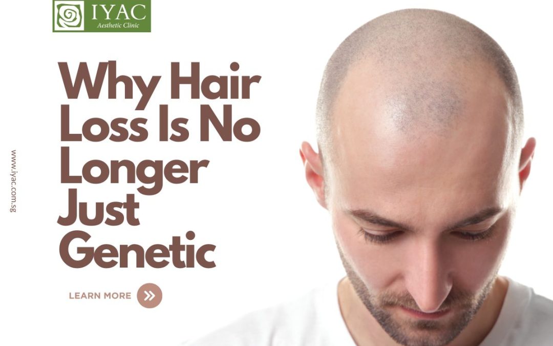 Why Hair Loss Is No Longer Just Genetic