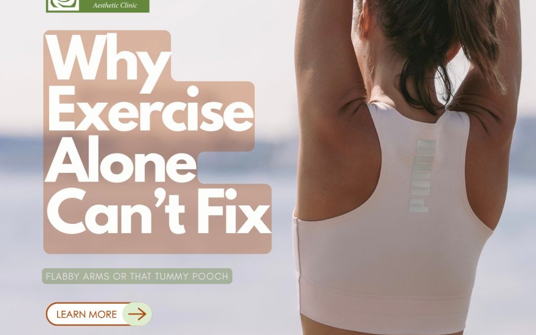 Why Exercise Alone Can’t Fix Flabby Arms or That Tummy Pooch