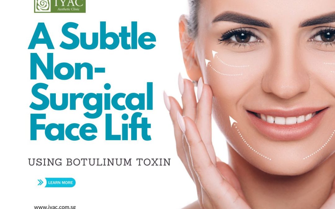 A Subtle Non-Surgical Face Lift Using Botulinum Toxin: 5 Things to Know