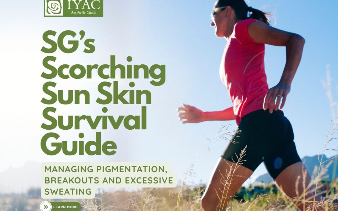 SG’s Scorching Sun Skin Survival Guide